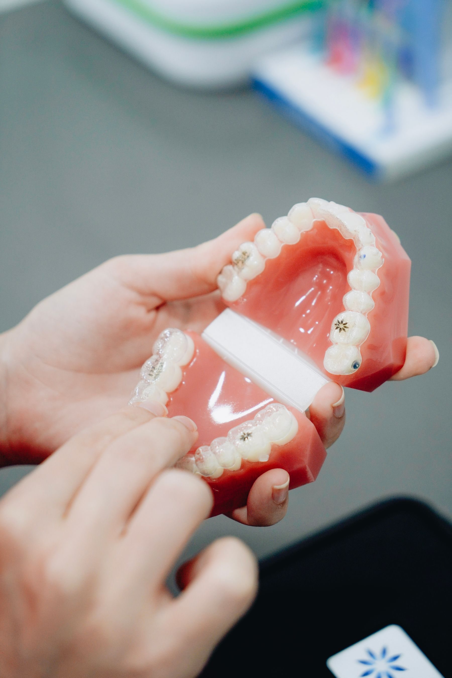 Modelo dent&aacute;rio com faceta