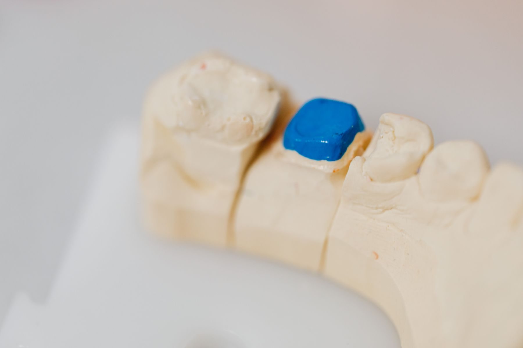 Modelo dent&aacute;rio para planejamento do sorriso