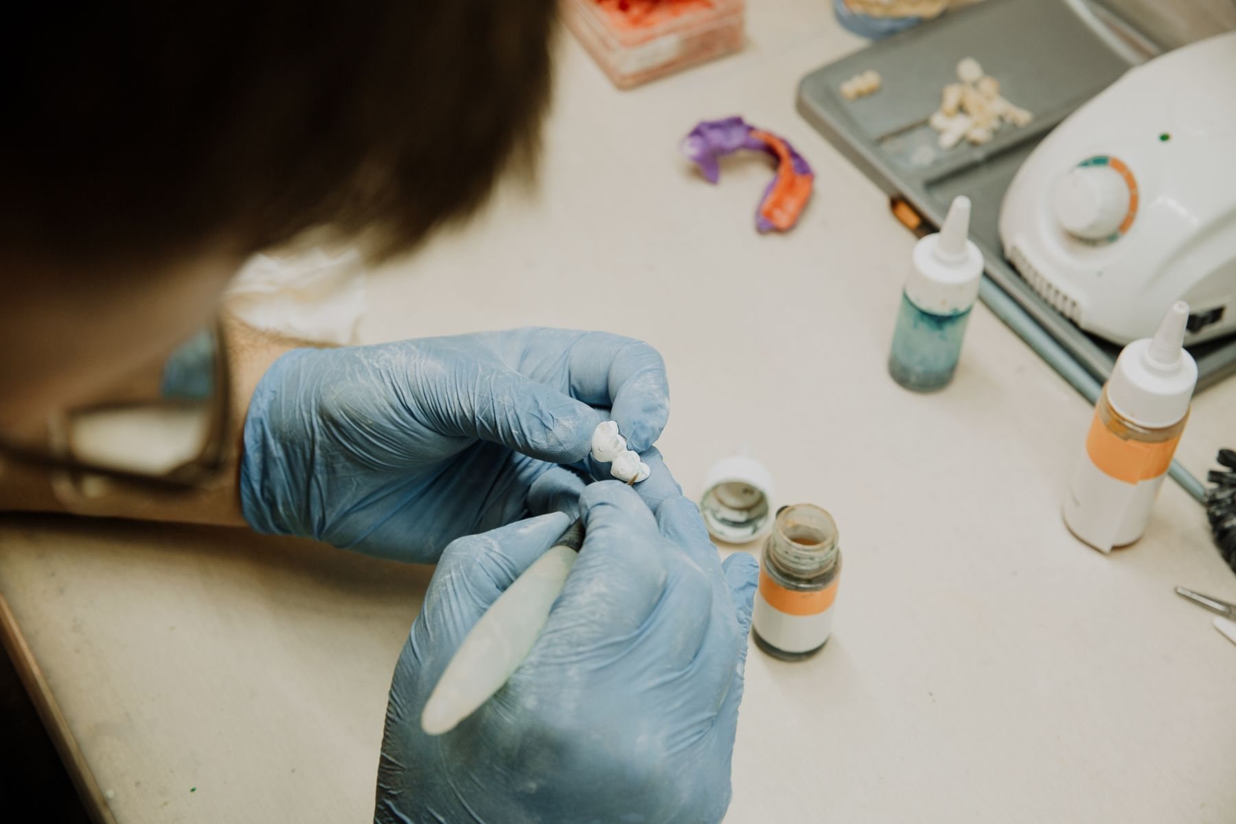 Trabalho de laborat&oacute;rio em pr&oacute;tese de porcelana