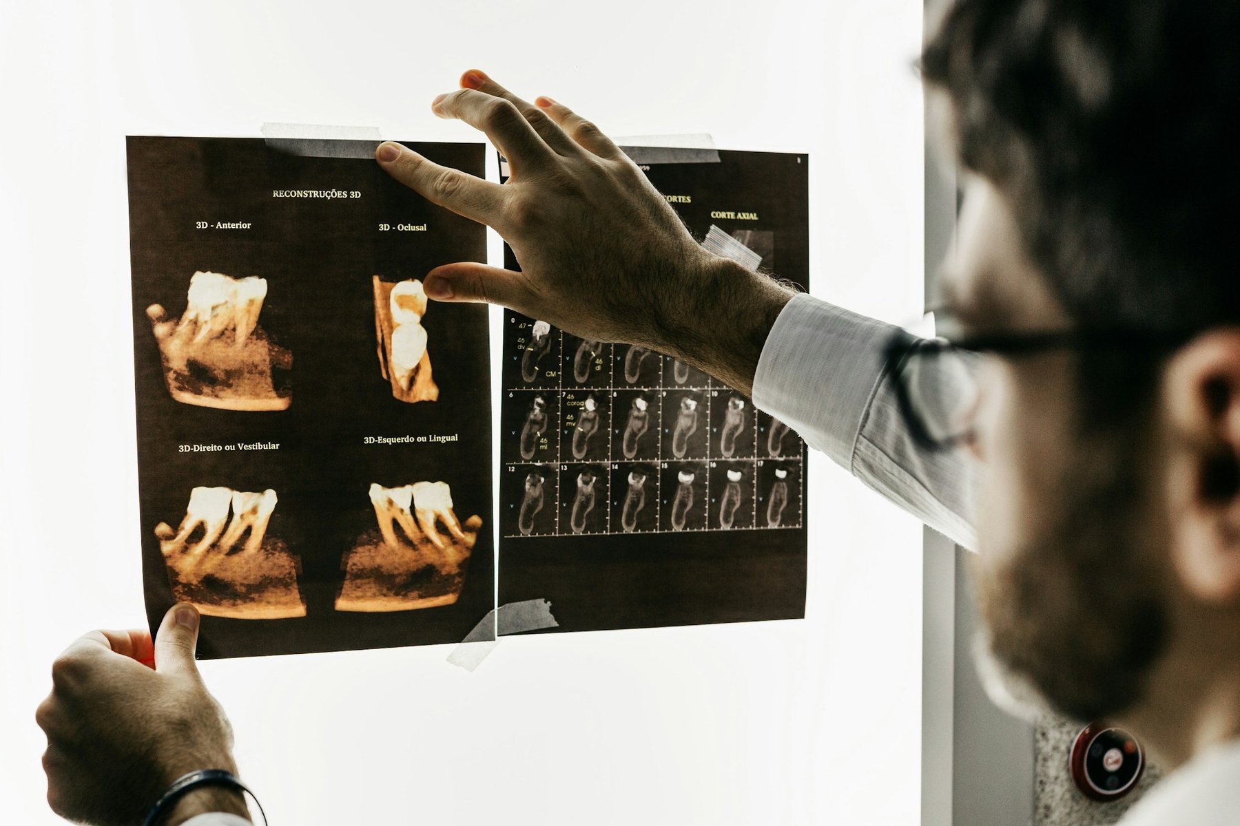 Dentista analisando tomografia e radiografias na avalia&ccedil;&atilde;o inicial